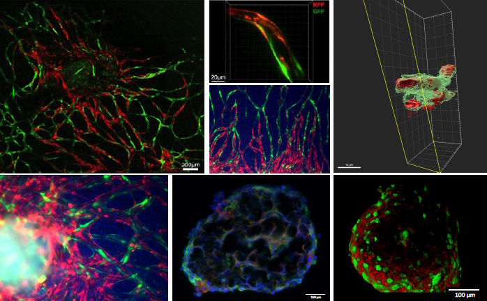 Clichés de microscopie